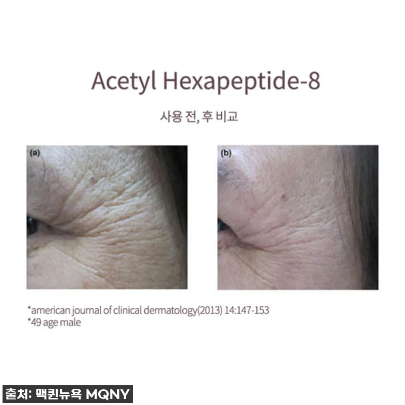 이 가격 실화?! 맥퀸뉴욕 콜라겐 비 관련 이미지 5