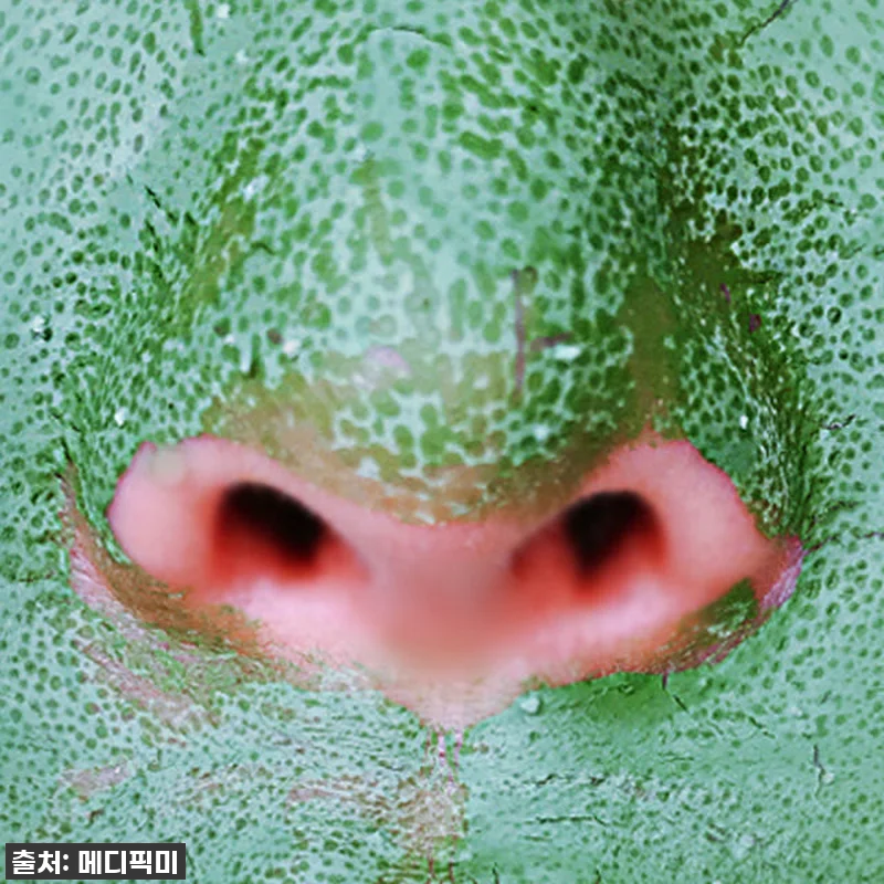 찐후기: 환절기 모공 고민 끝! 메디 관련 이미지 2