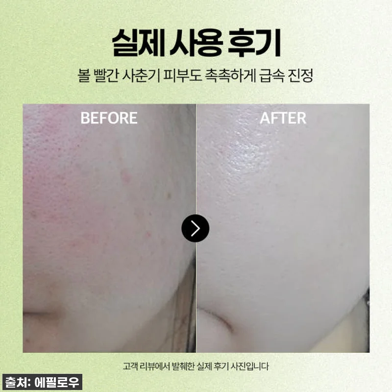 🚨품절임박🚨 찐후기! 에필로우 아티초 관련 이미지 3