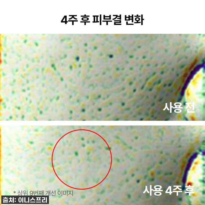 이니스프리 블랙티 앰플, 지친 피부에 광명 찾은 찐후기! 품절되기 전에 쟁여두세요! 10 이니스프리 블랙티 앰플, 지친 피부에 관련 이미지 4