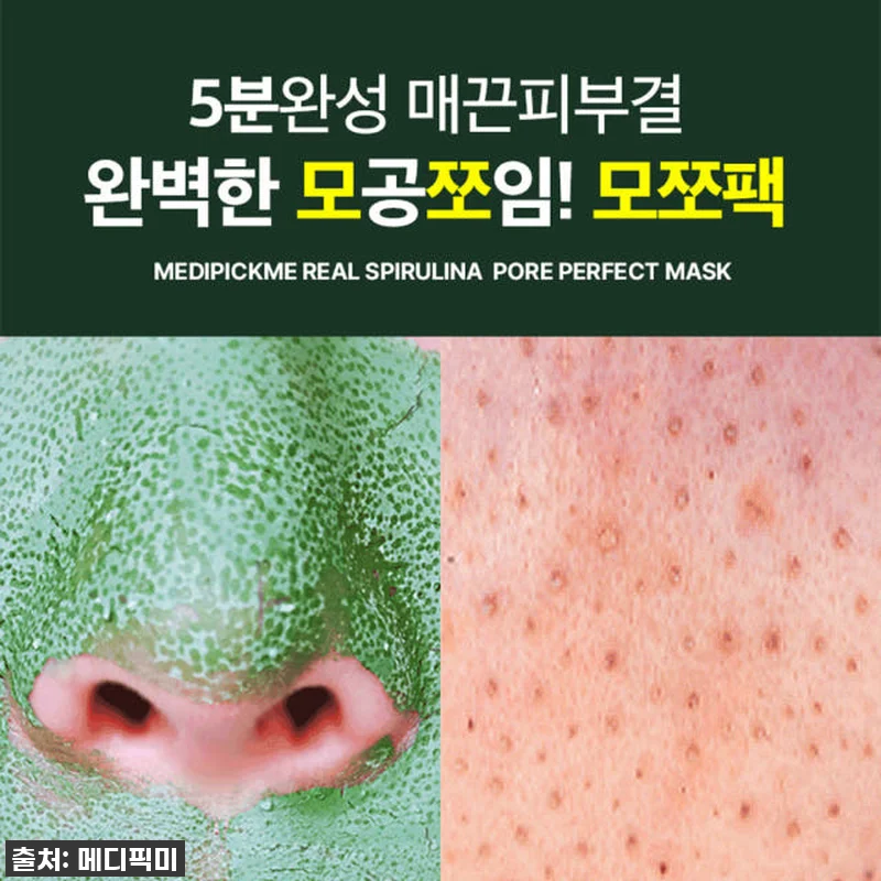 찐후기: 환절기 모공 고민 끝! 메디 관련 이미지 4