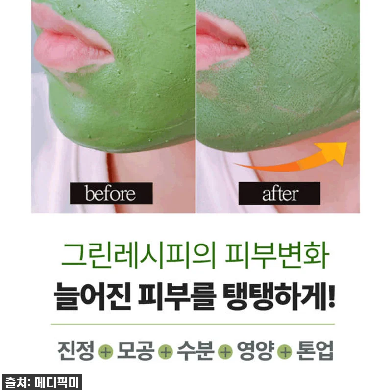 찐후기: 환절기 모공 고민 끝! 메디 관련 이미지 6