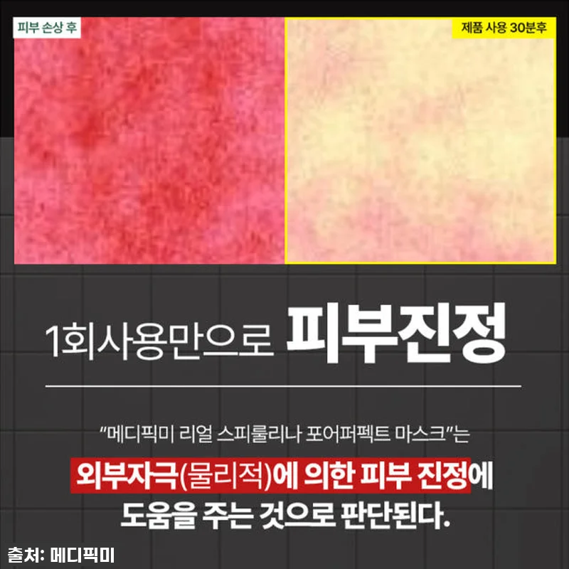 찐후기: 환절기 모공 고민 끝! 메디 관련 이미지 8