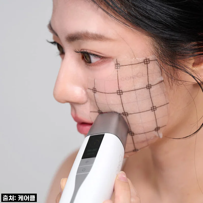 써마지 10년 경력자가 개발한 케어클 테크핏 스탬핑샷, 직접 사용해본 고주파 마사지기 후기