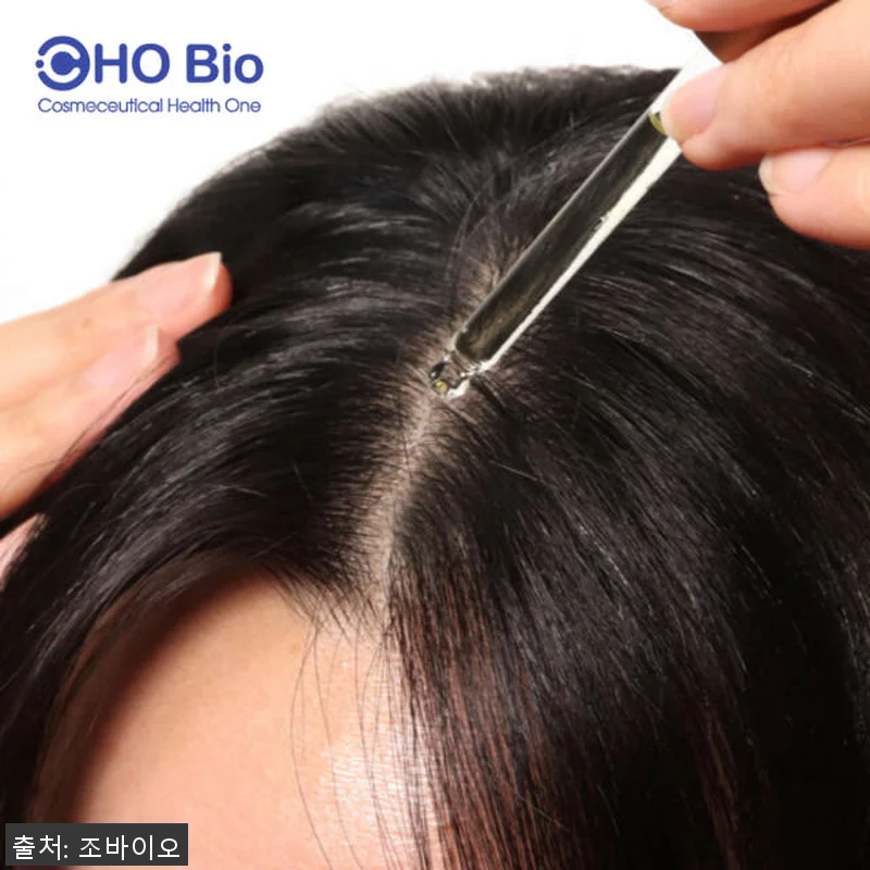 조바이오 마니숱 플러스 정수리 탈모 관련 이미지 1