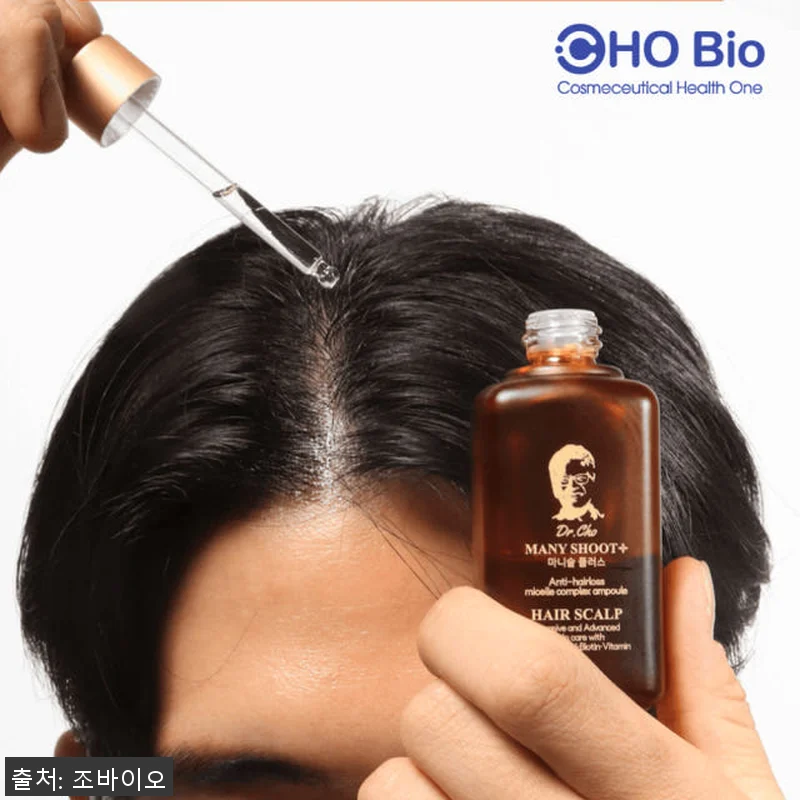 조바이오 마니숱 플러스 정수리 탈모 관련 이미지 2