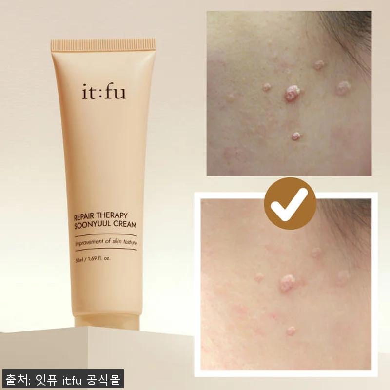 [사용후기] 율무 나이아신아마이드 순 관련 이미지 7